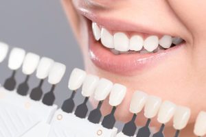 Teeth Whitening - Including Zoom! in Reno, NV